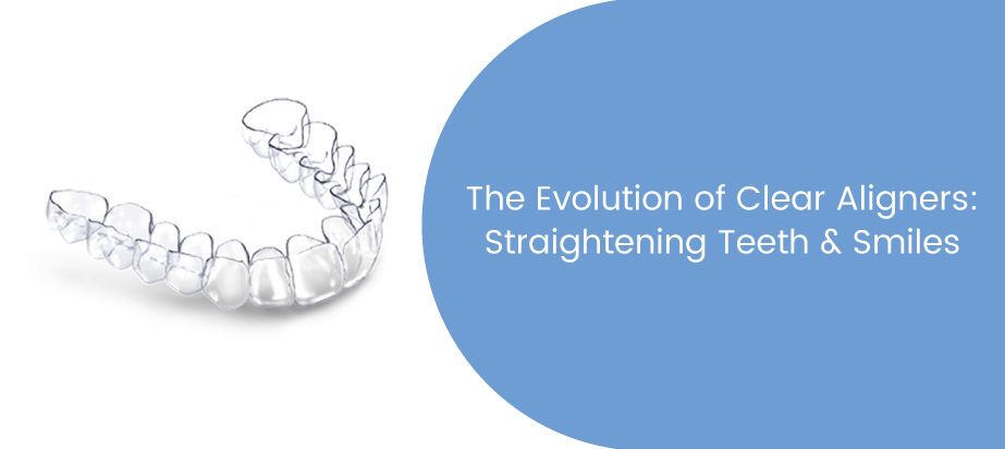 Evolution of Clear Aligners: Straightening Teeth & Smiles The Evolution of Clear Aligners: Straightening Teeth & Smiles